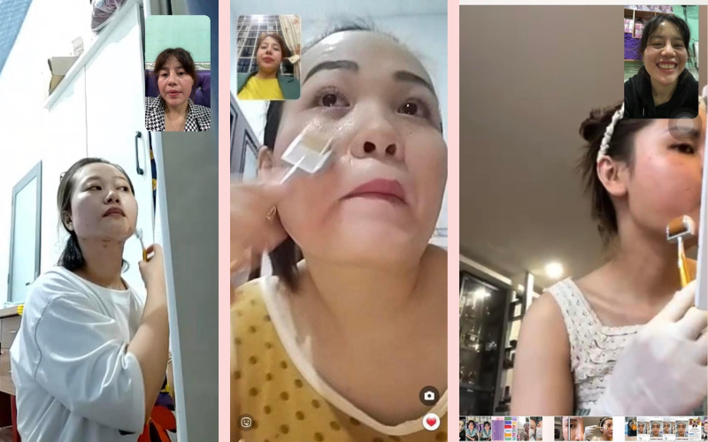 mỹ phẩm trị mụn trị rỗ