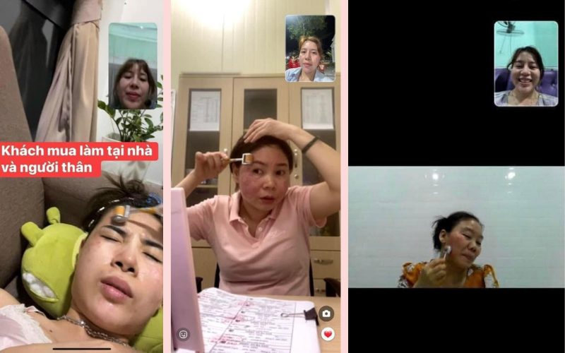 mỹ phẩm trị mụn trị rỗ