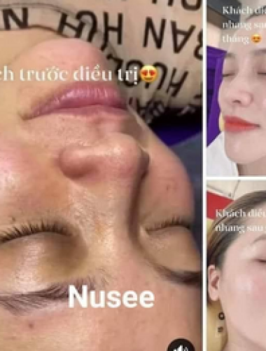 Đây phản hồi của khách em