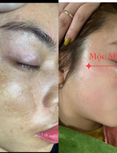 MỘC MỸ NHÂN NUSEE THANH THÚY 